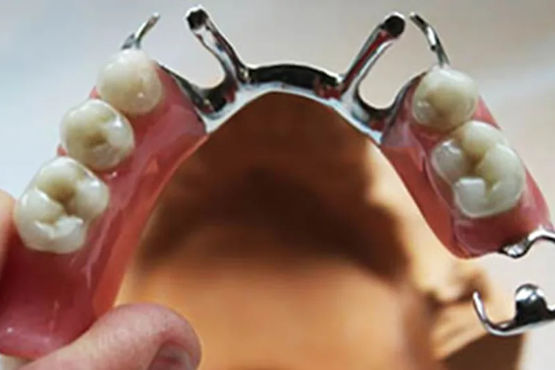 Natural-looking full dentures